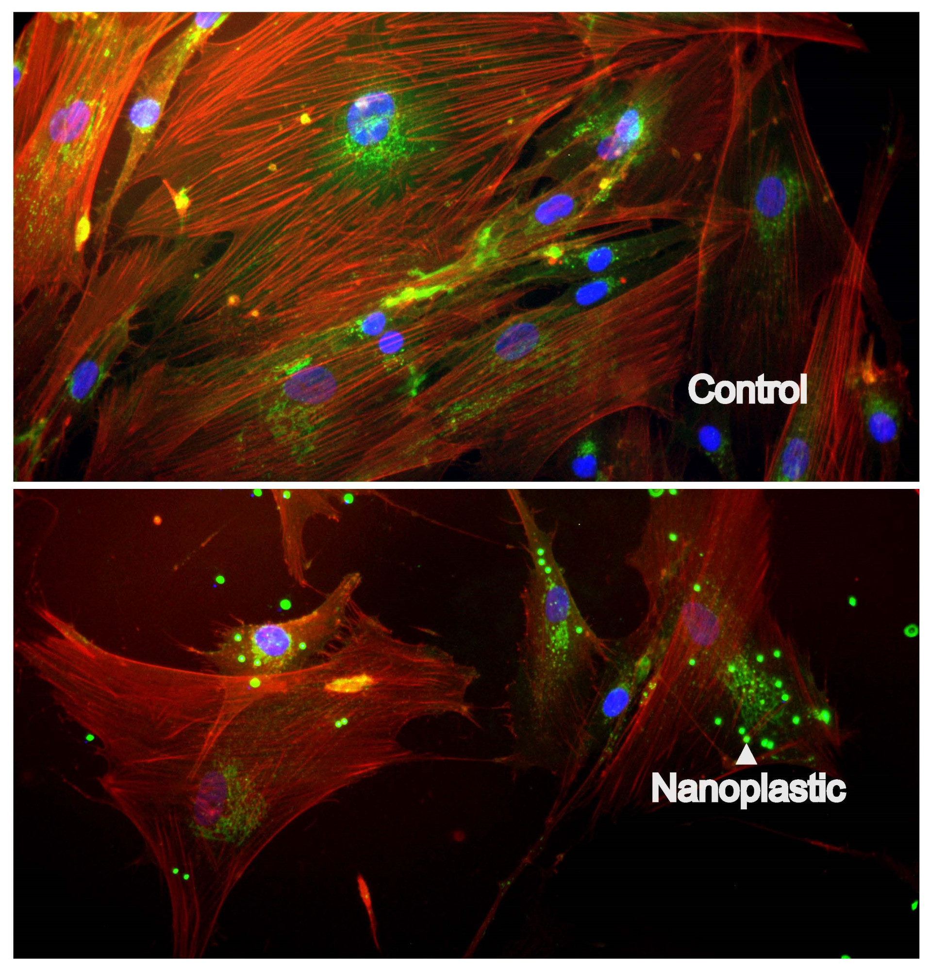 Liderado por investigadores do Centro de Ciências do Mar do Algarve (CCMAR) e da Universidade do Algarve (UAlg), este estudo revela os efeitos dos nanoplásticos nas células da pele.