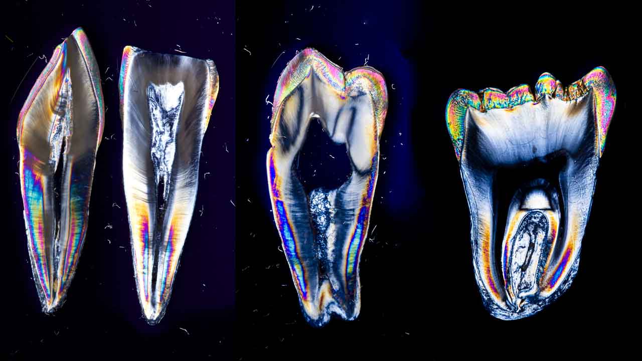 Laboratório sediado em Faro tem vindo a apostar na transição digital da medicina dentária. Smile Shape distingue-se pela qualidade ergonómica das próteses que produz com estado da arte da tecnologia. Além do mercado interno, exportar para a Europa.
